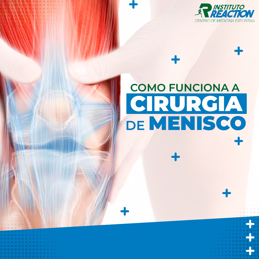 Como funciona a cirurgia de menisco