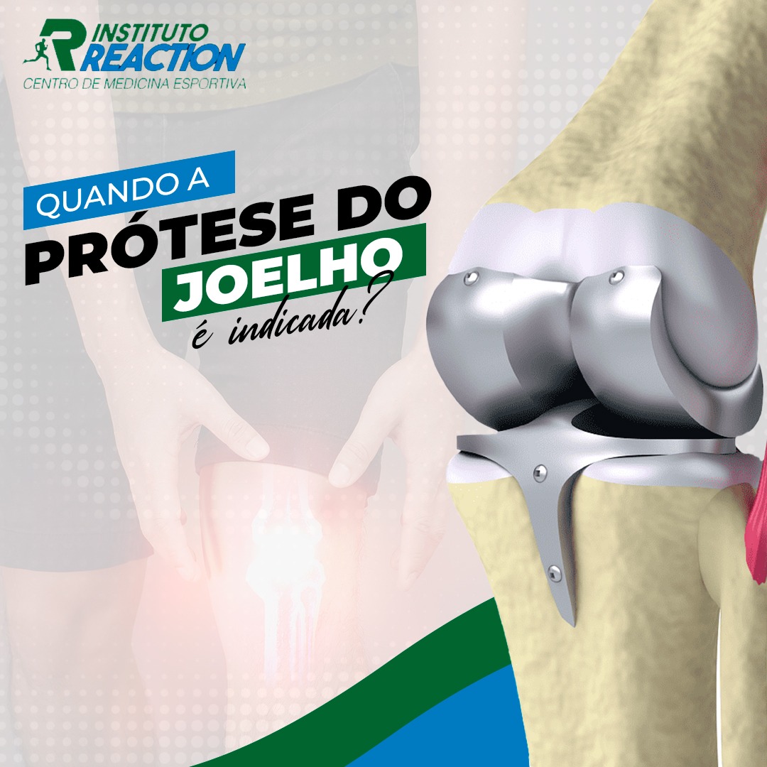 Quando a prótese de joelho é indicada