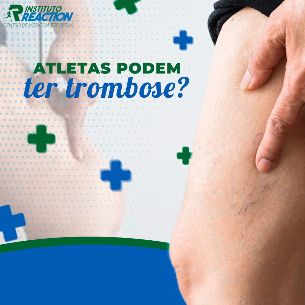 Atletas podem sofrer de trombose?