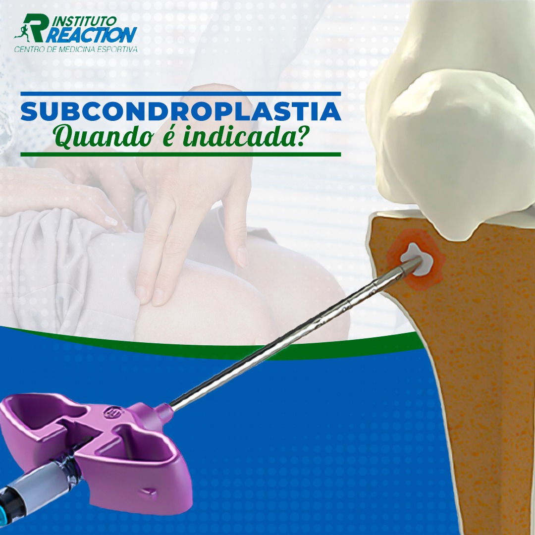 subcondroplastia quando é indicada