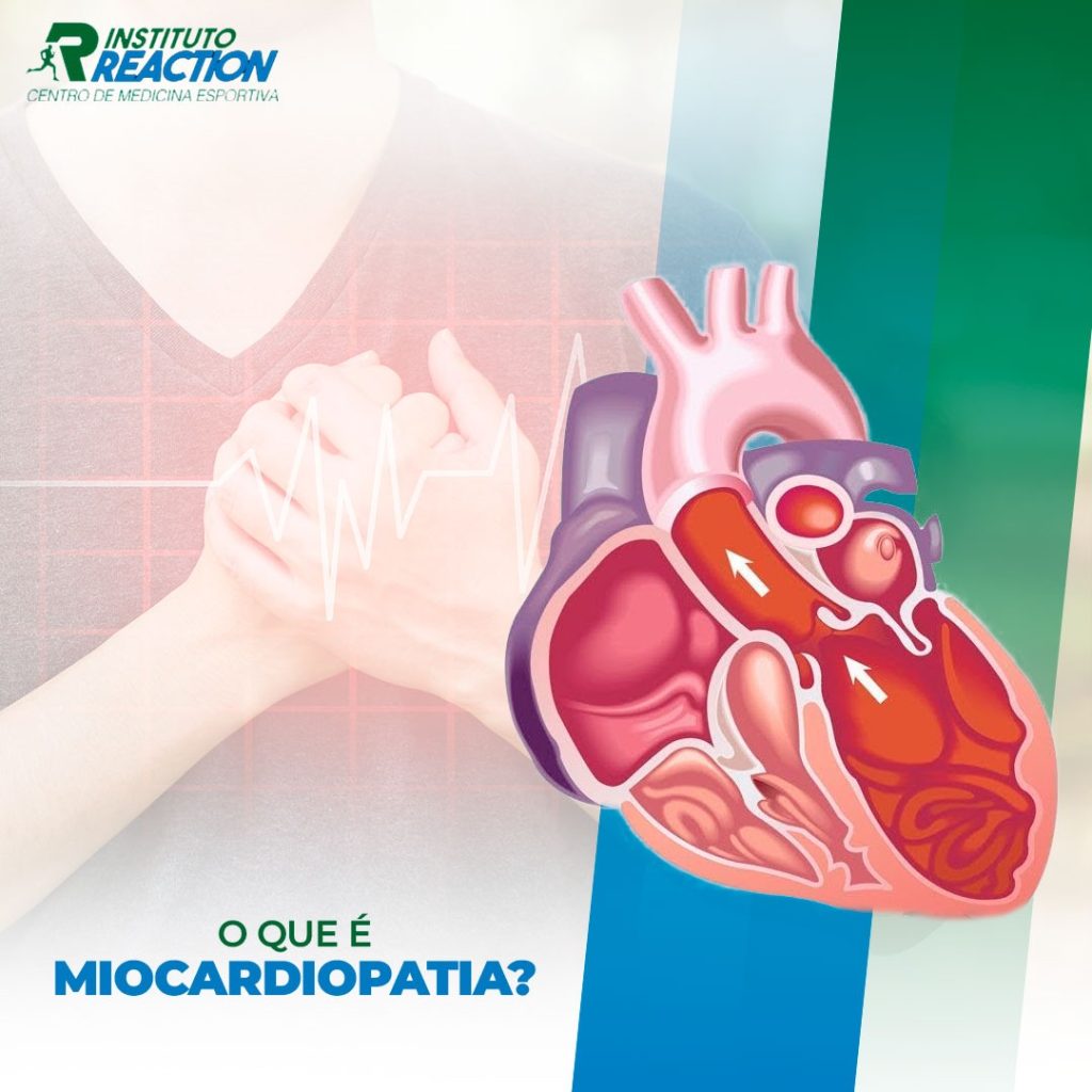miocardiopatia