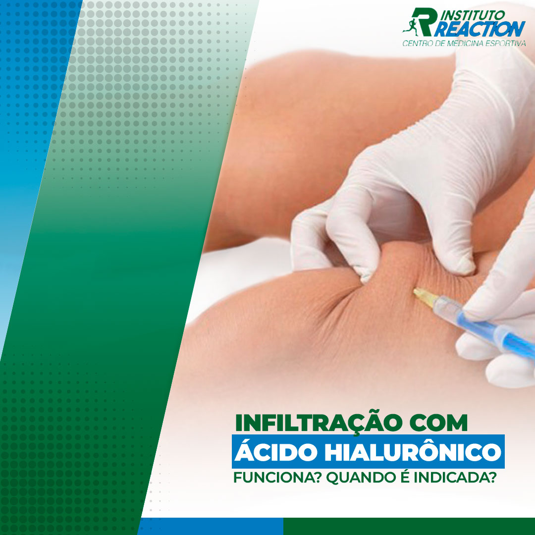 infiltração com ácido hialuronico