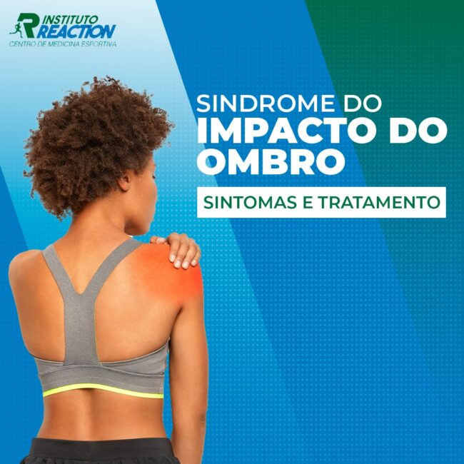 Síndrome do impacto do ombro sintomas e tratamentos