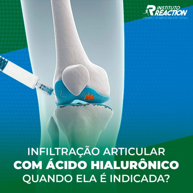 infiltração articular