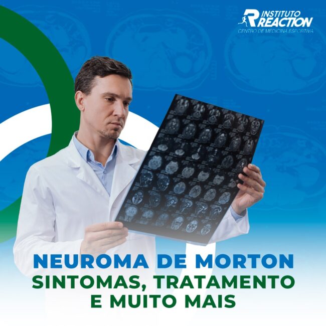 Neuroma de morton