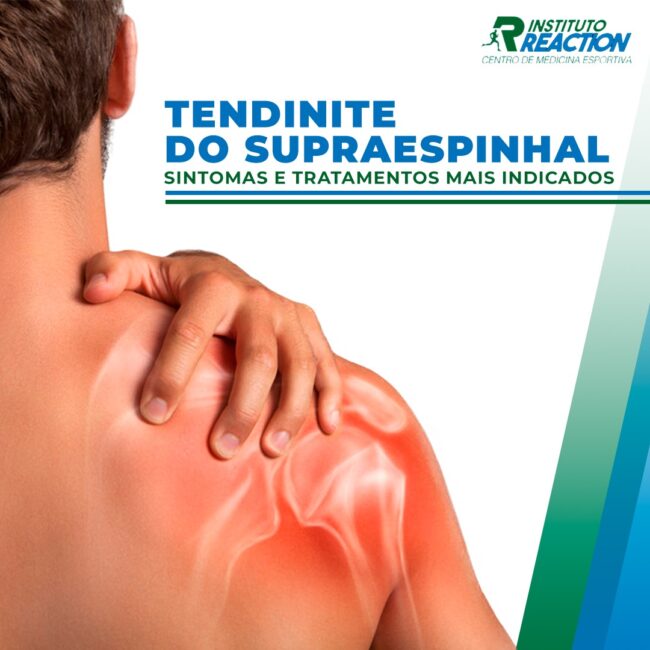 tendinite do supraespinhal
