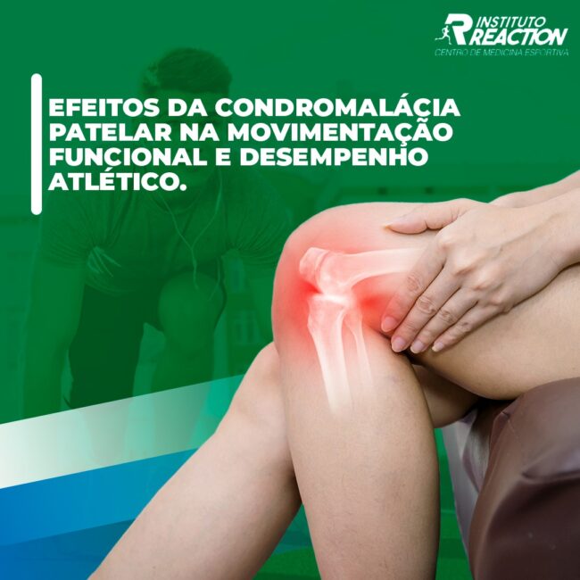 Efeitos da condromalácia patelar na movimentação funcional e desempenho atlético.