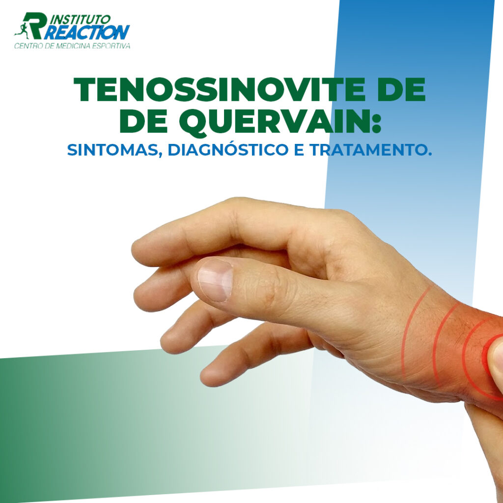 tenossinovite de Quervain