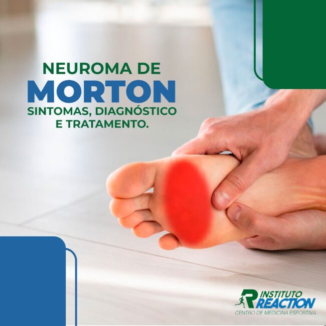 Neuroma de Morton