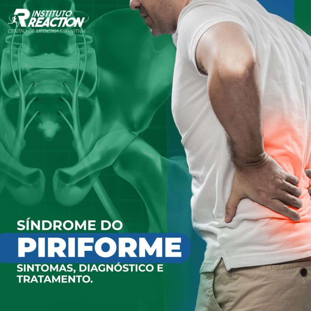  síndrome do piriforme