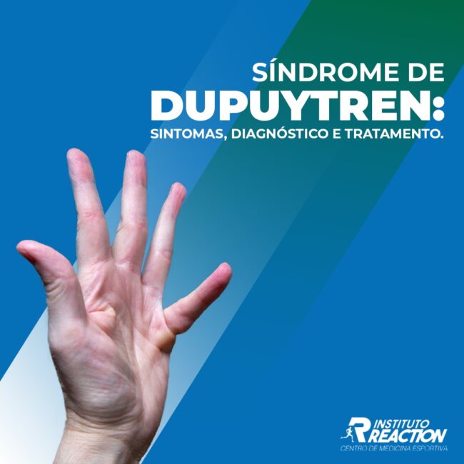 Síndrome de dupuytren