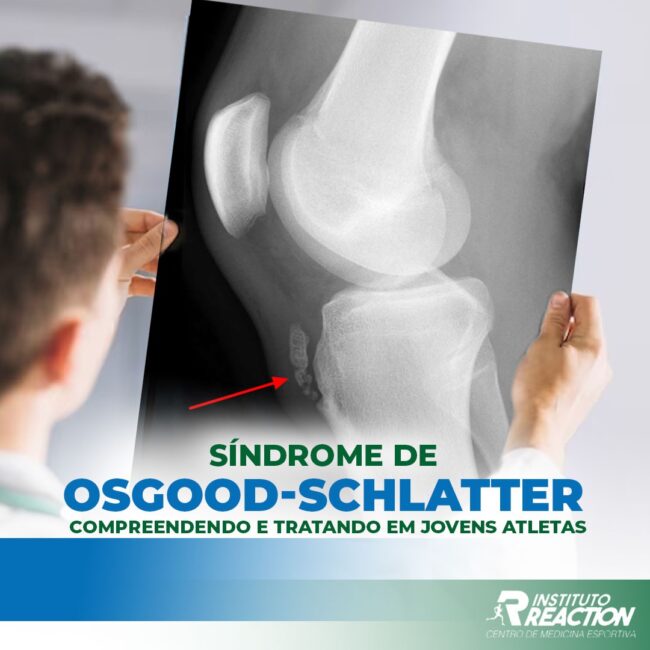 Osgood-Schlatter