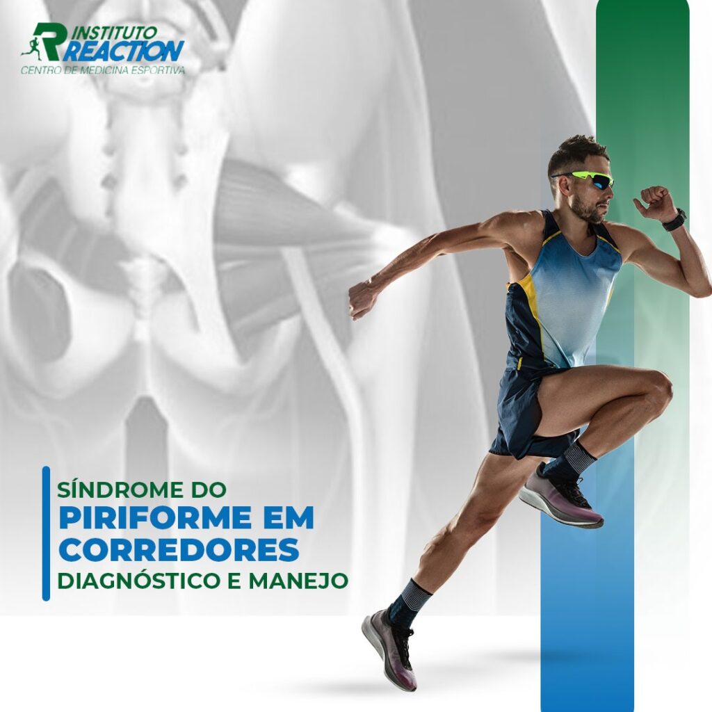 Síndrome do Piriforme