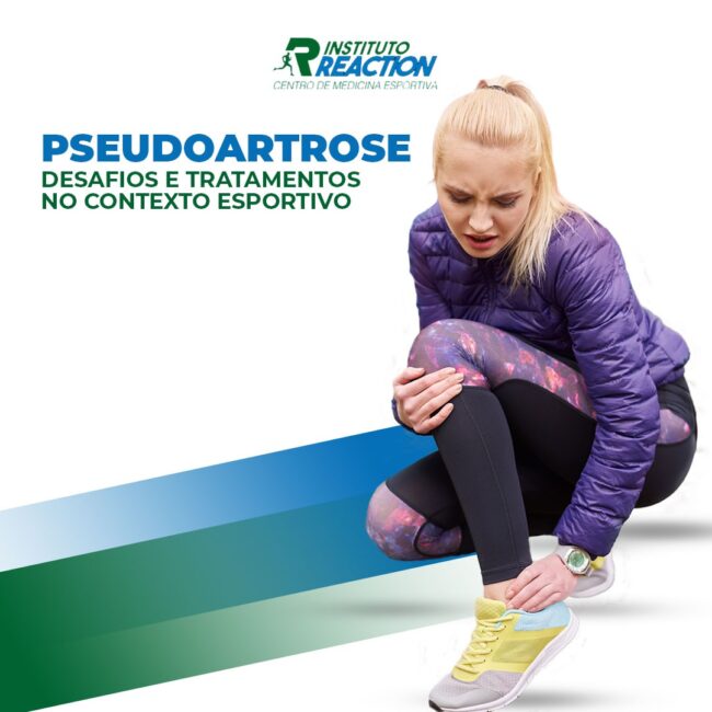 Pseudoartrose: Desafios e Tratamentos no Contexto Esportivo