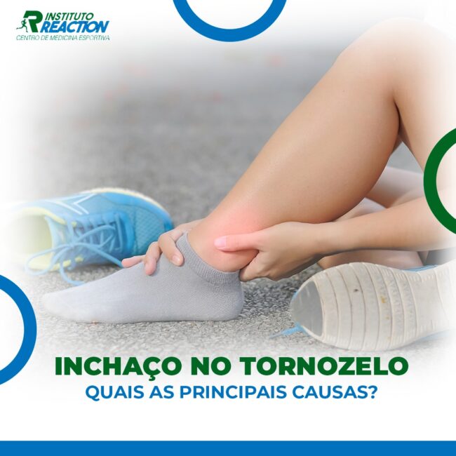 Inchaço no tornozelo Quais as principais causas