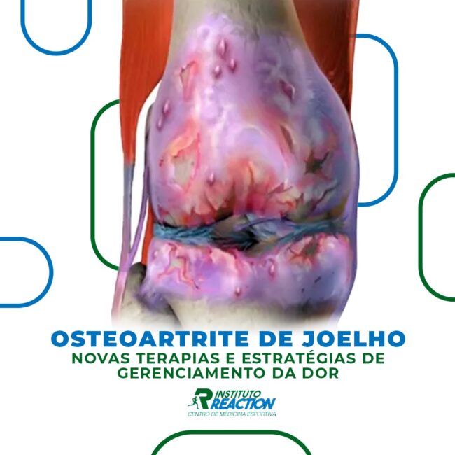 Osteoartrite de Joelho