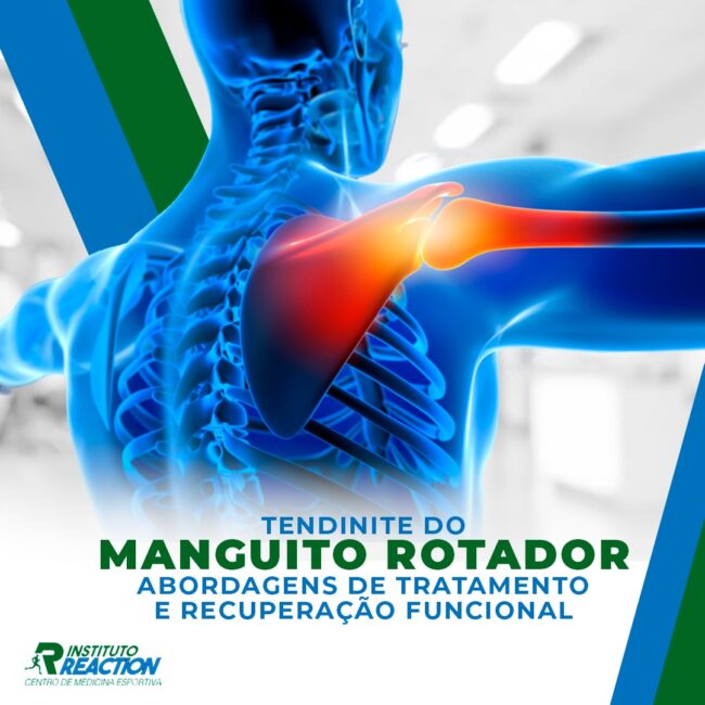 Tendinite do Manguito Rotador Abordagens de Tratamento e Recuperação Funcional