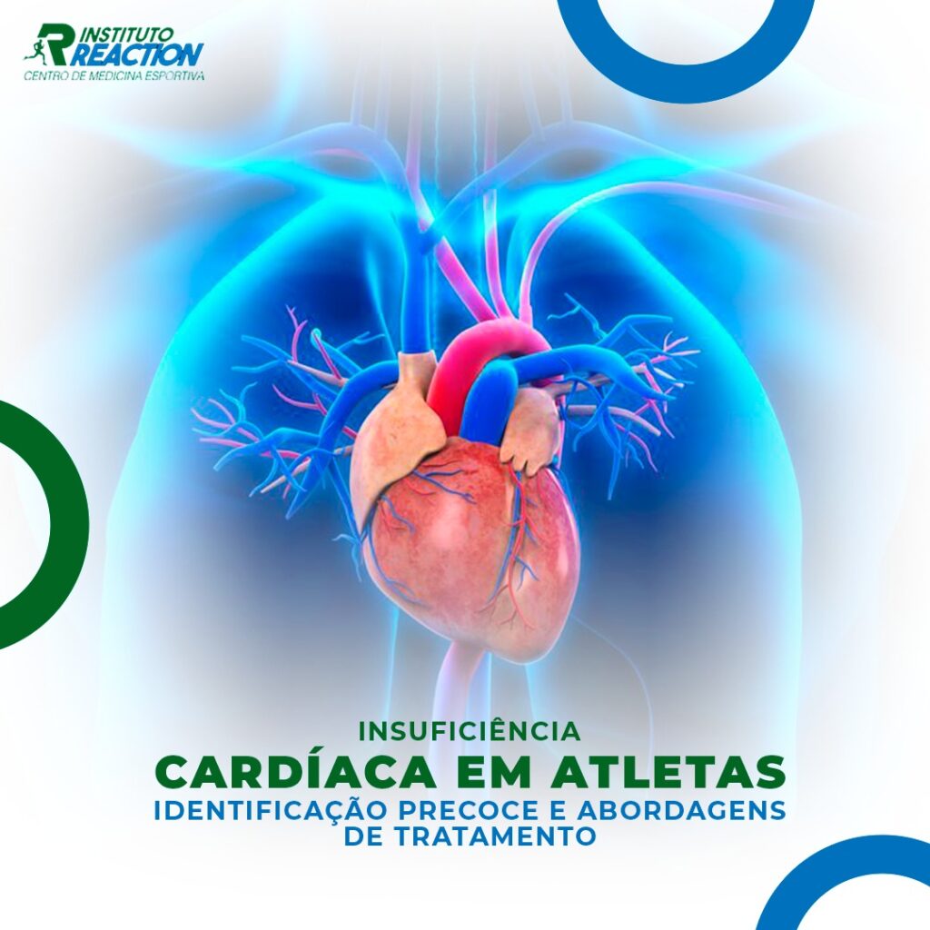 Insuficiência Cardíaca em Atletas Identificação Precoce e Abordagem de Tratamento